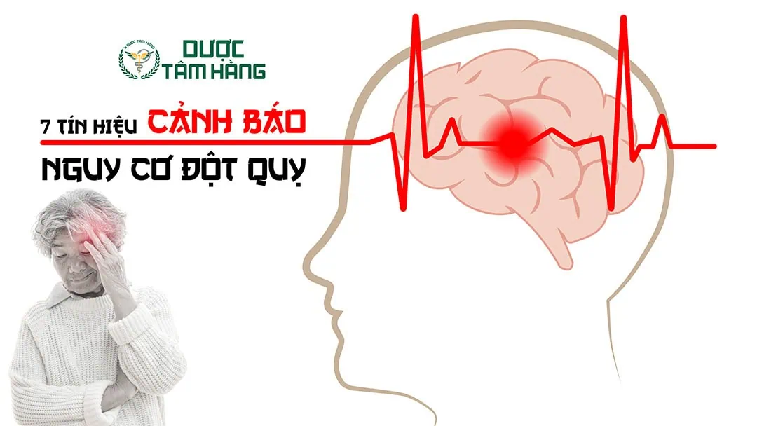 7 dấu hiệu vàng cảnh báo đột quỵ: nhận biết sớm để nắm giữ thời gian quý báu